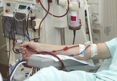 Dialysis process